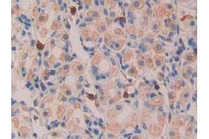 Detection of TGFa in Human Kidney Tissue using Polyclonal Antibody to Transforming Growth Factor Alpha (TGFa) (TGFA antibody  (AA 24-98))