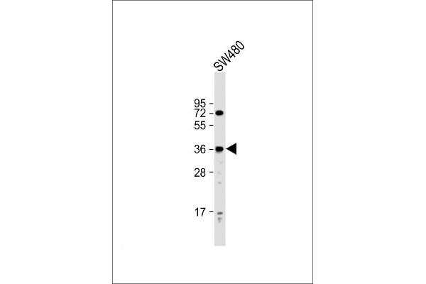 PRSS23 Antikörper  (AA 156-191)