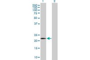 Western Blot analysis of COMMD10 expression in transfected 293T cell line by COMMD10 MaxPab polyclonal antibody.