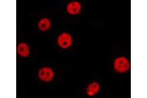 ABIN6274025 staining MCF7 by IF/ICC. (MYB antibody  (C-Term))