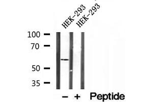 Western blot analysis of extracts of HEK-293 cells, using PPAT antibody. (PPAT antibody  (N-Term))