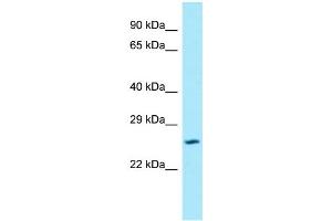 Western Blotting (WB) image for anti-Solute Carrier Family 17 Member 1 (SLC17A1) (N-Term) antibody (ABIN2789875) (SLC17A1 antibody  (N-Term))