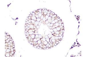 Immunohistochemistry of paraffin-embedded rat testis using RHOA/RHOB/RHOC Rabbit mAb (ABIN1678636, ABIN3019244, ABIN3019245 and ABIN7101735) at dilution of 1:100 (40x lens). (RhoA,B,C antibody)