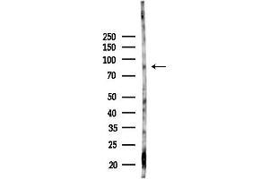 anti-Ribosomal Protein S6 Kinase, 90kDa, Polypeptide 6 (RPS6KA6) (C-Term) antibody