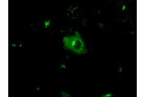 Anti-APP mouse monoclonal antibody (ABIN2452766) immunofluorescent staining of COS7 cells transiently transfected by pCMV6-ENTRY APP (RC221339). (APP antibody)