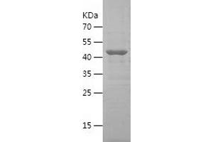 Western Blotting (WB) image for CTP Synthase (CTPS) (AA 375-591) protein (His-IF2DI Tag) (ABIN7122511) (CTP Synthase Protein (CTPS) (AA 375-591) (His-IF2DI Tag))
