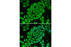 Immunofluorescence analysis of U2OS cell using TCL1A antibody. (TCL1A antibody)