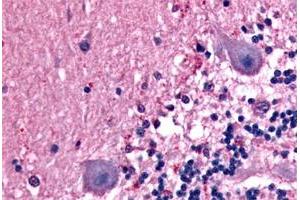 Immunohistochemical staining of formalin-fixed, paraffin-embedded human brain, neurons tissue after heat-induced antigen retrieval. (BAI1 antibody  (C-Term))