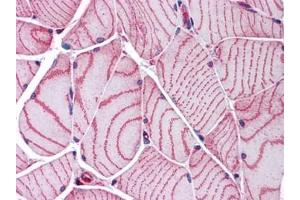 Human Skeletal Muscle: Formalin-Fixed, Paraffin-Embedded (FFPE) (ACTN2 antibody)