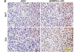 Inhibition of MBNL1-AS1 promoted the tumorigenesis of BC cells through the regulation of miR-135a/PHLPP2/FOXO1 in vivo. (Ki-67 antibody  (AA 700-800))