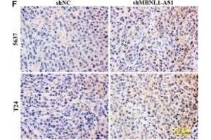 Inhibition of MBNL1-AS1 promoted the tumorigenesis of BC cells through the regulation of miR-135a/PHLPP2/FOXO1 in vivo. (Ki-67 antibody  (AA 700-800))