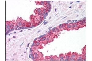 Human Prostate: Formalin-Fixed, Paraffin-Embedded (FFPE) (KLHL15 antibody  (C-Term))