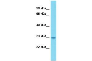 Western Blotting (WB) image for anti-Olfactory Receptor 872 (OLFR872) (Middle Region) antibody (ABIN2774471)