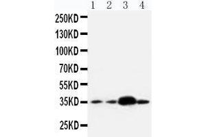 Anti-APE1 antibody, Western blotting Lane 1: U87 Cell Lysate Lane 2: A549 Cell Lysate Lane 3: SMMC Cell Lysate Lane 4: HELA Cell Lysate
