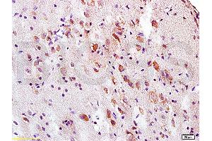 Formalin-fixed and paraffin embedded rat brain tissue labeled with Anti-Tau protein Polyclonal Antibody (ABIN668391), Unconjugated at 1:200, followed by conjugation to the secondary antibody and DAB staining (tau antibody  (AA 683-758))