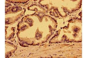 Immunohistochemistry of paraffin-embedded human prostate tissue using ABIN7159593 at dilution of 1:100 (MARS2 antibody  (AA 225-460))