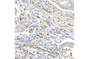 Immunohistochemistry (IHC) image for anti-Mitochondrial Import Receptor Subunit TOM20 homolog (TOMM20) (AA 20-145) antibody (ABIN7268554)