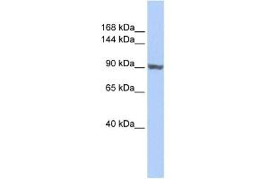 WB Suggested Anti-TNNI3K Antibody Titration:  0. (TNNI3K antibody  (Middle Region))