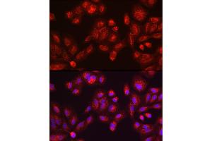 Immunohistochemistry of paraffin-embedded mouse testis using GALC antibody (ABIN1679950, ABIN3018222, ABIN3018224 and ABIN6220405) at dilution of 1:100 (40x lens). (GALC antibody  (AA 40-300))