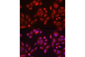 Immunohistochemistry of paraffin-embedded mouse testis using GALC antibody (ABIN1679950, ABIN3018222, ABIN3018224 and ABIN6220405) at dilution of 1:100 (40x lens). (GALC antibody  (AA 40-300))