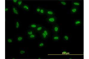 Immunofluorescence of monoclonal antibody to TAF11 on HeLa cell.