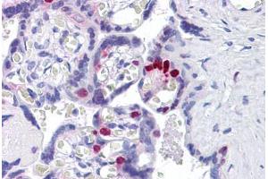 Human Placenta: Formalin-Fixed, Paraffin-Embedded (FFPE) (FOXO4 antibody  (N-Term))