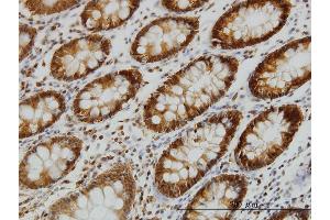 Immunoperoxidase of monoclonal antibody to EPB41 on formalin-fixed paraffin-embedded human colon. (EPB41 antibody  (AA 116-225))