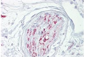 Nerve stained with CA2D1 Antibody in Immunohistochemistry on Paraffin Sections (CACNA2D1 antibody)