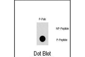 Dot blot analysis of Phospho-TSC2- polyclonal antibody (ABIN1881949 and ABIN2839674) on nitrocellulose membrane.