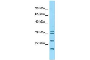 Western Blotting (WB) image for anti-Interferon, kappa (IFNK) (C-Term) antibody (ABIN2789152) (IFNK antibody  (C-Term))
