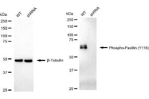 Western blotting analysis using Phospho-Paxillin (Y118) antibody (ABIN7799745).