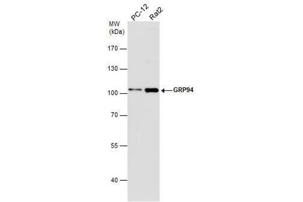 GRP94 抗体  (C-Term)