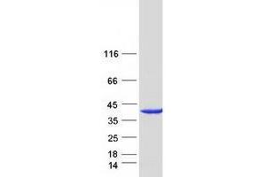 Western Blotting (WB) image for Uracil phosphoribosyltransferase (FUR1) Homolog (UPRT) protein (Myc-DYKDDDDK Tag) (ABIN2735053)