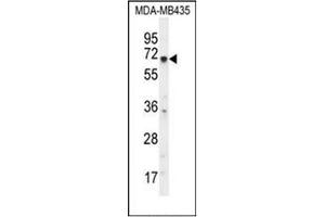 Western blot analysis of KCNQ1 Antibody (N-term) in MDA-MB435 cell line lysates (35ug/lane).