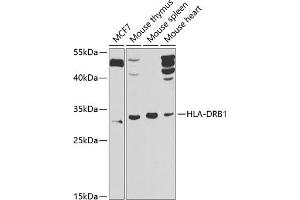 Western blot analysis of extracts of various cell lines, using HLA-DRB1 antibody (ABIN6131759, ABIN6141831, ABIN6141832 and ABIN6223610) at 1:1000 dilution. (HLA-DRB1 antibody  (AA 30-230))