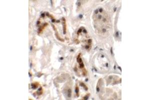Immunohistochemical analysis of DBX1 in human kidney tissue with DBX1 polyclonal antibody  at 2. (DBX1 antibody  (Internal Region))