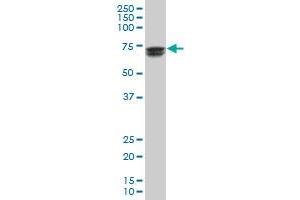 GATAD2A polyclonal antibody (A01), Lot # 051004JC01 Western Blot analysis of GATAD2A expression in Jurkat . (GATAD2A antibody  (AA 26-134))
