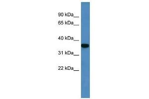 Western Blot showing Decr2 antibody used at a concentration of 1-2 ug/ml to detect its target protein.