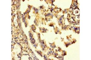 Immunohistochemistry of paraffin-embedded human lung tissue using ABIN7153489 at dilution of 1:100 (GABRA6 antibody  (AA 20-242))