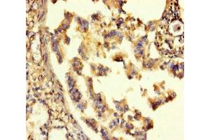 Immunohistochemistry of paraffin-embedded human lung tissue using ABIN7153489 at dilution of 1:100