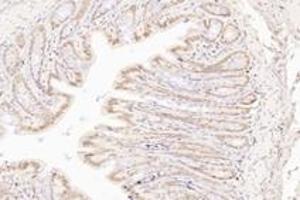 Immunohistochemistry analysis of paraffin-embedded rat colon using,TORC1 (ABIN7073590) at dilution of 1: 800 (CRTC1 antibody)