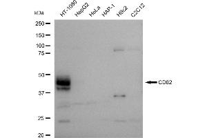 Western blotting analysis using CD82 antibody (ABIN7797982). (Recombinant CD82 antibody)