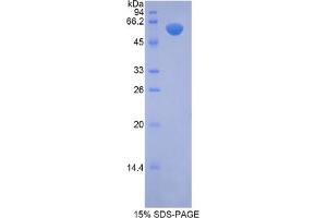 N-Acetyl alpha-D-Glucosaminidase protein
