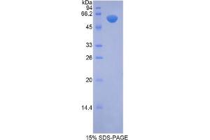 SDS-PAGE analysis of Mouse NAGLU Protein. (N-Acetyl alpha-D-Glucosaminidase Protein)