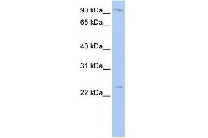 WB Suggested Anti-OSBPL8 Antibody Titration:  0. (OSBPL8 antibody  (N-Term))