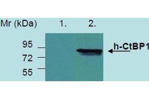 Western Blotting analysis of recombinant protein h-CtBP1 produced in HEK 293 transfected cells. (CTBP1 antibody)