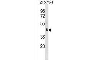 PCMTD2 Antibody (C-term) (ABIN1536944 and ABIN2849981) western blot analysis in ZR-75-1 cell line lysates (35 μg/lane). (PCMTD2 antibody  (C-Term))