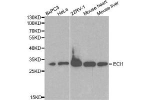 Western blot analysis of extracts of various cell lines, using ECI1 antibody. (DCI antibody)
