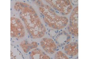 Used in DAB staining on fromalin fixed paraffin- embedded Kidney tissue (LAMC2 antibody  (AA 28-196))