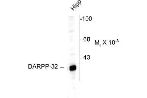 Western Blotting (WB) image for anti-Protein Phosphatase 1, Regulatory (Inhibitor) Subunit 1B (PPP1R1B) (N-Term) antibody (ABIN361423)